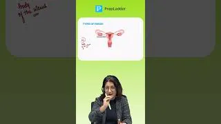 Thumbnail: Fibroids Risk Factors in 30 Seconds | NEET PG 2026 #shorts