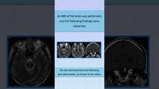 Thumbnail: Guess the Diagnosis | NEET PG Challenge ⚡ #neet #fmge #inicet