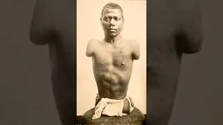 Thumbnail: The Human Caterpillar - Prince Randian