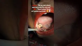 Thumbnail: When the condition is beyond repair 🤣🦷 #memes #bds #shorts #dental #dentist