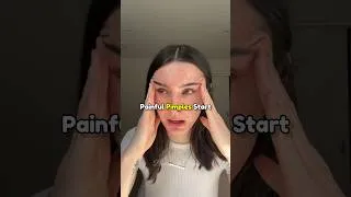 Thumbnail: How to Treat Hormonal Acne ||