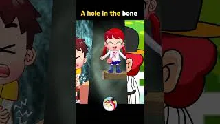 Thumbnail: Why Does Sam Have a Hole in His Bone? | Kids Health Science | REDMON
