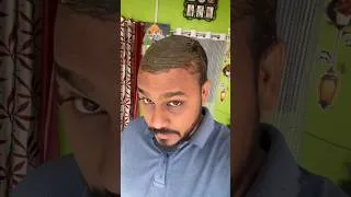 Thumbnail: #hairmask #minoxidil #finex #hairfall