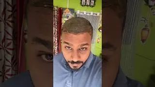 Thumbnail: #hairmask #hairfall #minoxidil #finex