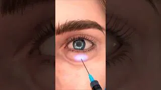 Thumbnail: Puffy Eye Surgery Explained | Lower Blepharoplasty Procedure Step by Step