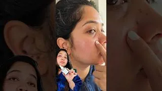 Thumbnail: 😊 যেভাবে স্কিন ঠিক করলাম #shorts #skincare