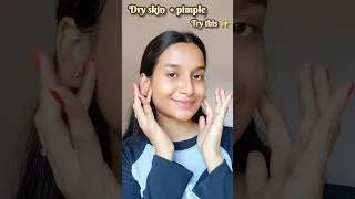 Thumbnail: Dry skin + pimple try this ✨#skincare #dryskin #pimple #dryskincareroutine #freethepimple #shorts