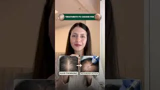 Thumbnail: Stop Choosing Treatments Randomly! Here’s What Your Skin Needs || Dr. Sarin ||