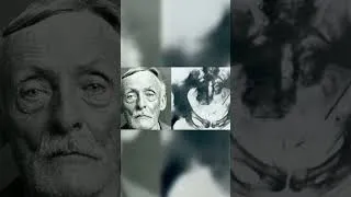 Thumbnail: Police Were Horrified By This X-Ray 😰 #albertfish #scary #truecrimecommunity