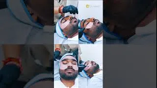 Thumbnail: Laser Skin Treatment: Full Procedure | Carbon Mask + Laser Treatment at Skinlogics