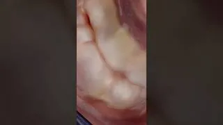 Thumbnail: A Rare View Inside the Human🫀
