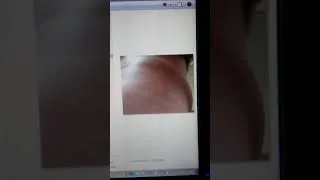 Thumbnail: More Pictures from my side