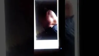 Thumbnail: Side is swollen as streaks go up towards my heart