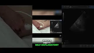 Thumbnail: Stanford DOCTOR Ultrasound Rocking Tips
