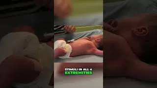 Thumbnail: Stanford Pediatric NEUROLOGIST Newborn Sensory Exam Tricks!