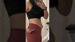 Thumbnail: Allison Ellsworth Tummy Tuck Update After 3 Kids and Poppi Deal shorts