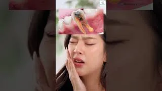 Thumbnail: 🦷Don't wait for pain to visit the dentist! | smilex_dental_clinic | Dr. R N Patil’s Suraj Hospital