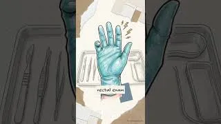 Thumbnail: Large Bowel Obstruction- Acute Abdomen