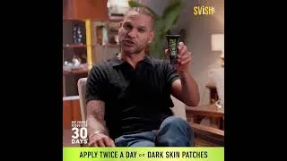 Thumbnail: Dark Patches on Neck, Knee, Elbow, and Underarms? Use Svish Dark Patches Reducer Cream.