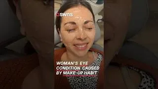 Thumbnail: Woman's "genetic dry eyes" was common condition from 20 year make-up habit | SWNS