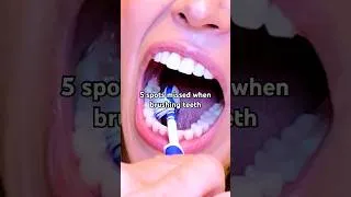Thumbnail: most missed toothbrushing spots #shorts