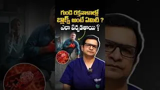 Thumbnail: Dr. Movva Srinivas : గుండె రక్త నాళాల్లో బ్లాక్స్ అంటే ఏమిటి ? - What Causes Heart Artery Blockage ?