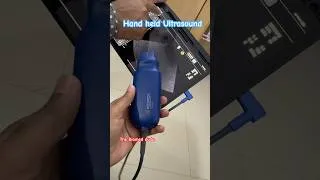 Thumbnail: Hand held ultrasound 💫 KOSMOS  #smartdevices #biomedical