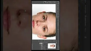 Thumbnail: How to Fix Acne in Photoshop & Camera Raw (Texture Saving Method)