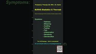 Thumbnail: BURNS (Radiation or Thermal) ? Rife Frequency Therapy | 60 Sec | #Shorts