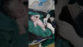 Thumbnail: New born baby #shorts