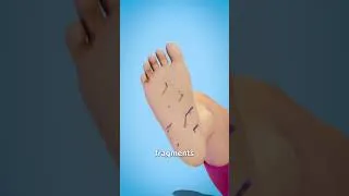 Thumbnail: Sea Urchin Spines [Info-graphics] [Shorts]