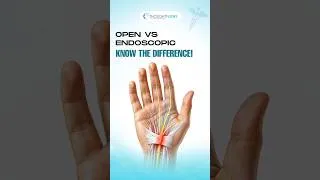 Thumbnail: Carpal Tunnel Release: CPT Coding from an Operative Report