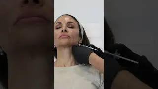 Thumbnail: Jaw Clenching/ Masseter Treatment