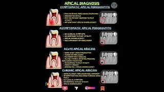 Thumbnail: Periapical diagnosis