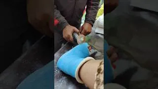 Thumbnail: পাহাড় চড়ার জন্য ready#shorts#trending#viral#broken#plaster