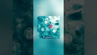 Thumbnail: Cyclospora parasite outbreak: What we know so far