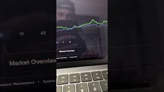 Thumbnail: Day 1 of Documenting my Journey to Financial Freedom  #optionstrading