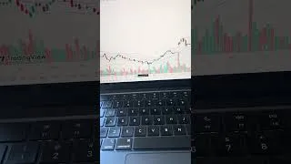 Thumbnail: I lost 10s of Thousands of dollars on AMD  #optionstrading