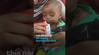 Thumbnail: You can help deliver a Packet of Hope to malnourished children.