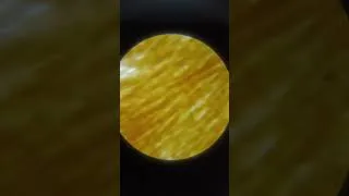 Thumbnail: Butterfly Wing Under The Microscope 100x...