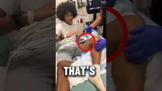 Thumbnail: He Tried to Do It Himself… But the Doctor Had to Step In 😂