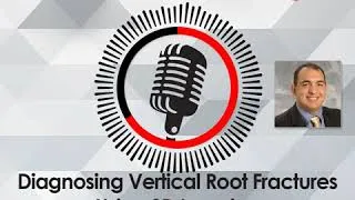 Thumbnail: Diagnosing Vertical Root Fractures Using 3D Imaging with Dr. Bruno Azevedo