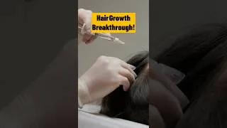 Thumbnail: Topical Fatty Acids for Hair Loss: The Future of Regrowth