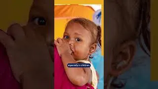 Thumbnail: What is Malaysia doing to achieve measles elimination by 2030?