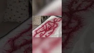 Thumbnail: This might be living in your mattress...