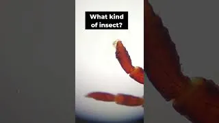 Thumbnail: what kind of insect? #science #microbes #microscope