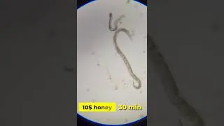 Thumbnail: Cheap and expensive honey vs parasite #microbes #microscope #science