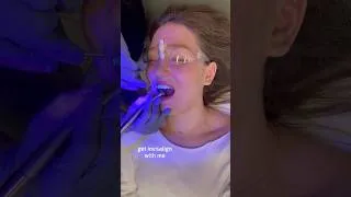 Thumbnail: get invisalign with me! 🦷