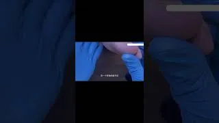 Thumbnail: After watching the process of foot repair, I feel relaxed all over!#foot  #pedicure  #automobile
