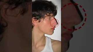Thumbnail: Try this Hack for your BIG NOSE